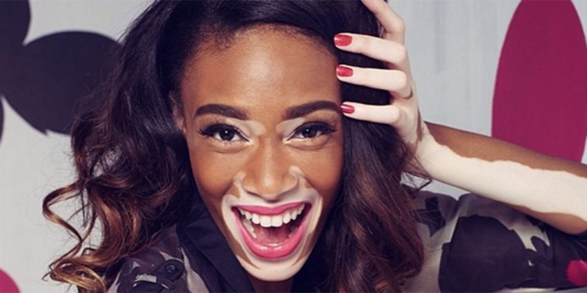 Winnie Harlow