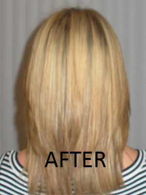 Test subject from back after treatment