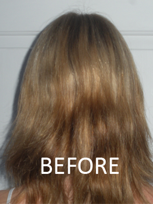 Test subject from back before treatment