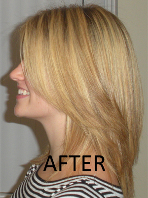 Test subject from side after treatment