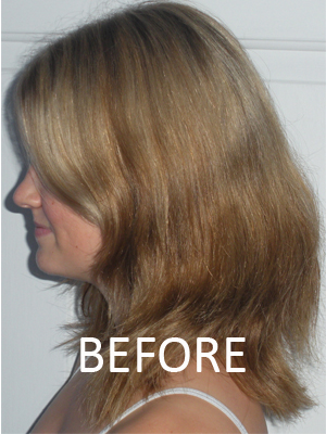 Test subject from side before treatment