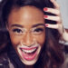 Winnie Harlow